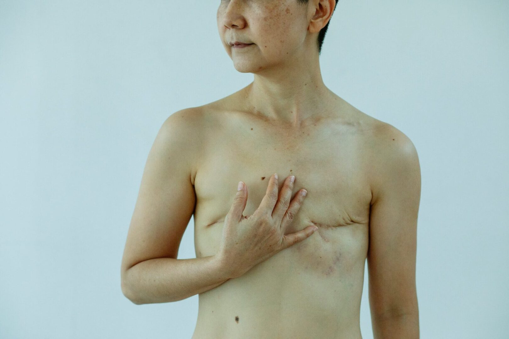 A woman with breast cancer is holding her chest.