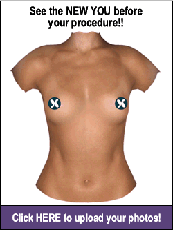 A woman with two breasts and nipples on her chest.